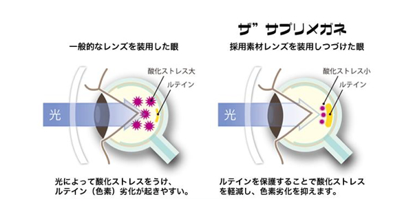 採用素材レンズを装着し続けた眼